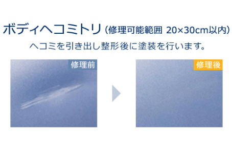 ボディヘコミトリ